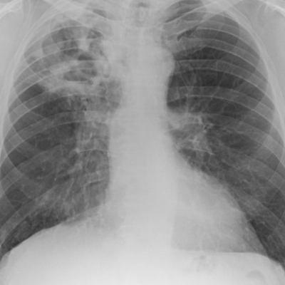 cxr